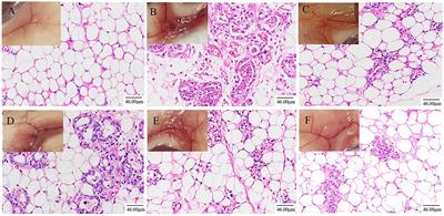 Total flavonoids of Abrus cantoniensis inhibit CD14/TLR4/NF-κB/MAPK pathway expression and improve gut microbiota disorders to reduce lipopolysaccharide-induced mastitis in mice